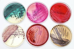 Microbial culture medium